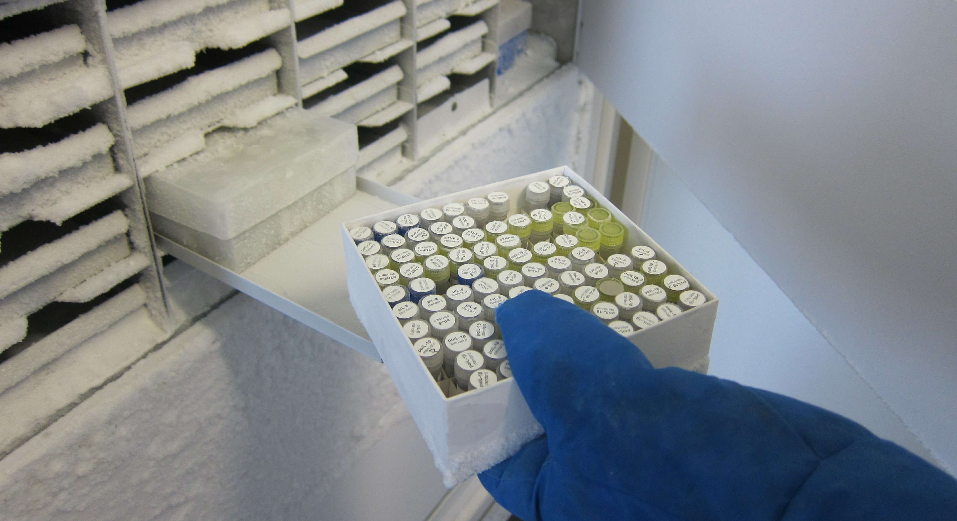 gloved hand with icy freezer and vials